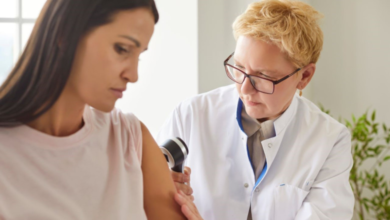 Cum deosebim urticaria provocată de alimente de înţepăturile de insecte. „Diagnosticul nu se stabileşte doar după aspectul pielii”